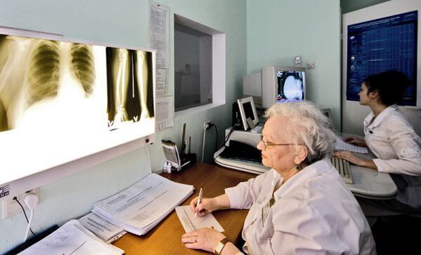 Radiografie per diagnosticare il mal di schiena
