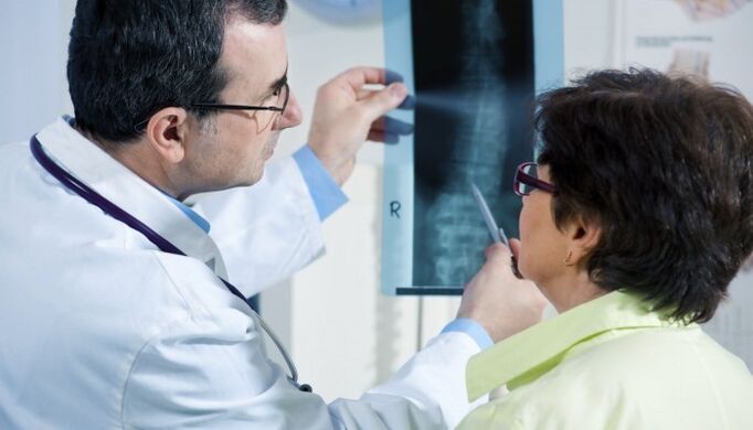 radiografia della colonna vertebrale con osteocondrosi