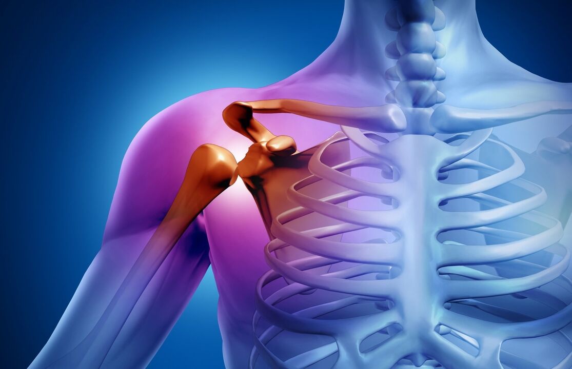 artrosi della spalla