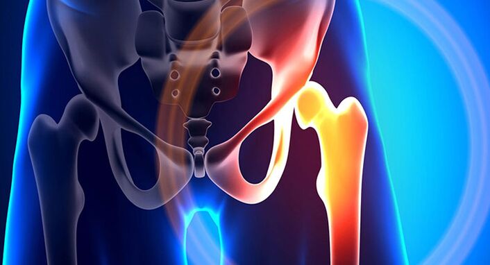 Il dolore all’anca è un sintomo di molte patologie diverse
