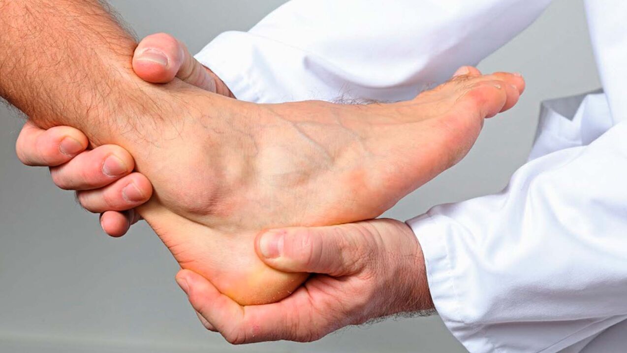 artrosi dell'articolazione della caviglia