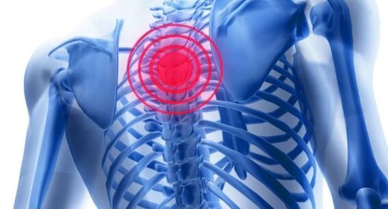 Trattamento dell'osteocondrosi della colonna vertebrale toracica
